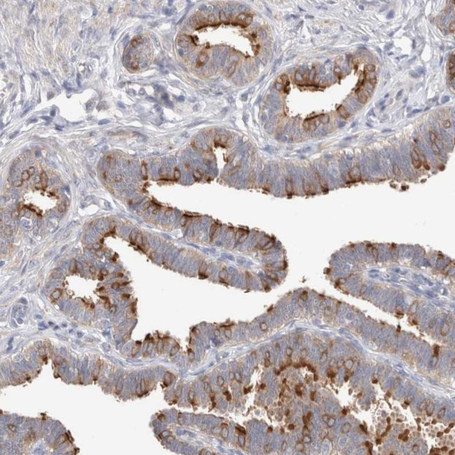 CMG1 Antibody in Immunohistochemistry (Paraffin) (IHC (P))