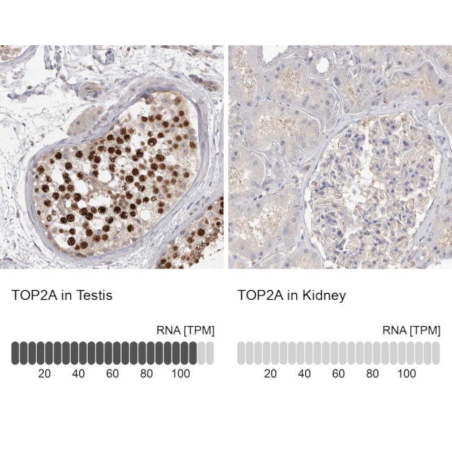 TOP2A Antibody in Immunohistochemistry (Paraffin) (IHC (P))