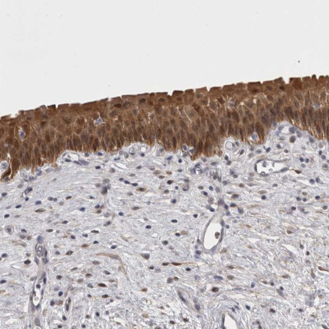 CHIC2 Antibody in Immunohistochemistry (Paraffin) (IHC (P))