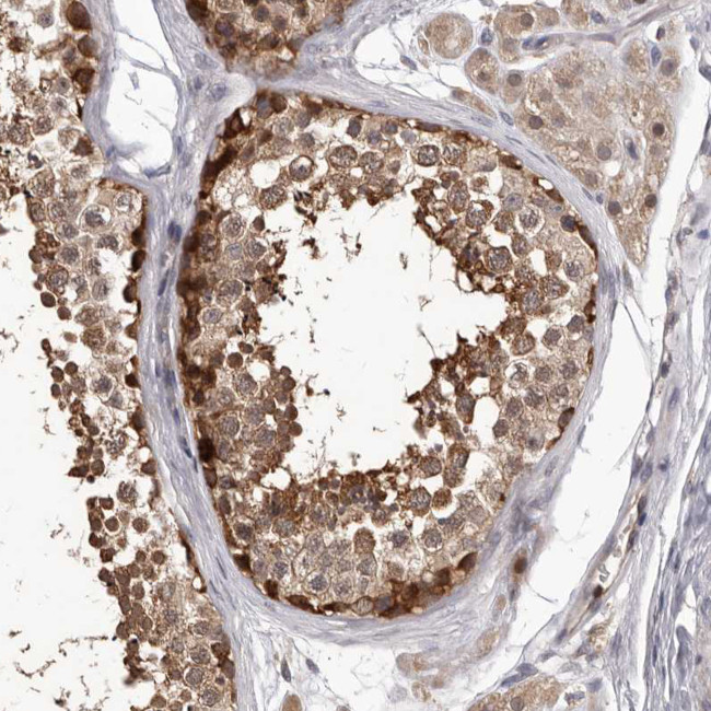 NIK Antibody in Immunohistochemistry (Paraffin) (IHC (P))