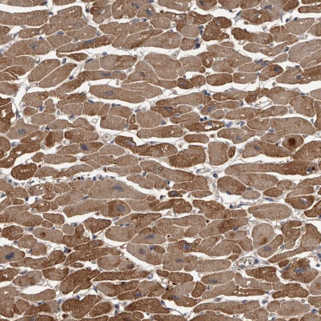 PDE7A Antibody in Immunohistochemistry (Paraffin) (IHC (P))