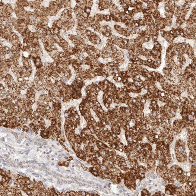 IL1R2 Antibody in Immunohistochemistry (Paraffin) (IHC (P))