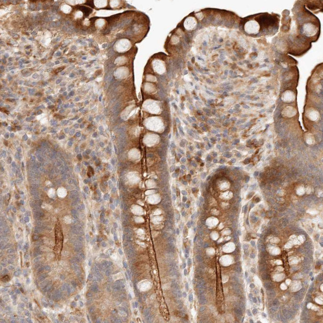IL1R2 Antibody in Immunohistochemistry (Paraffin) (IHC (P))