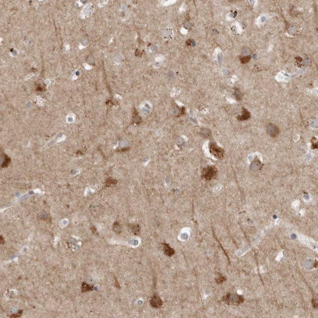 RANK Antibody in Immunohistochemistry (Paraffin) (IHC (P))