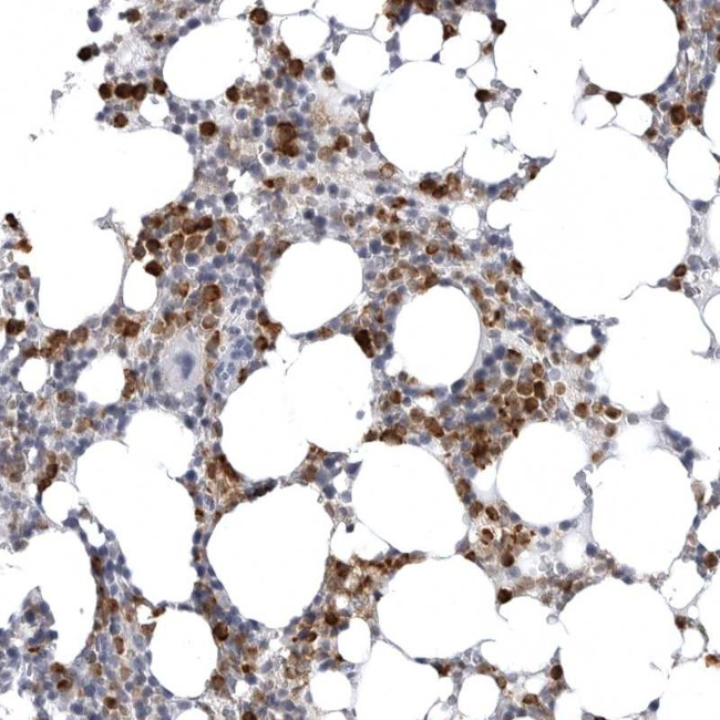 STAP2 Antibody in Immunohistochemistry (Paraffin) (IHC (P))