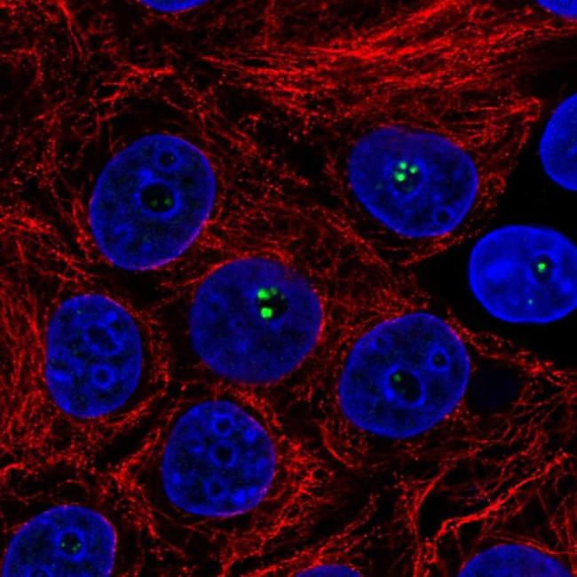 Coilin Antibody in Immunocytochemistry (ICC/IF)