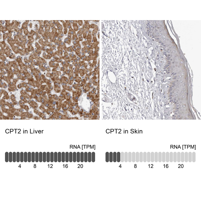CPT2 Antibody in Immunohistochemistry (Paraffin) (IHC (P))
