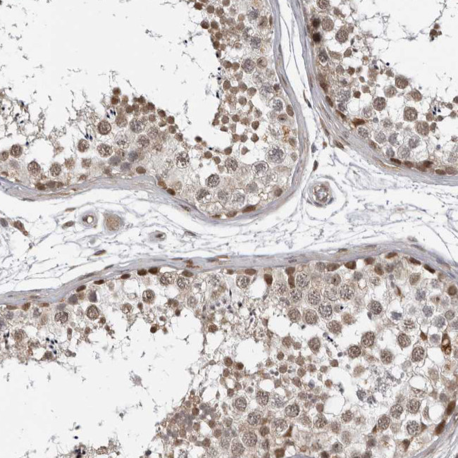 c-MAF Antibody in Immunohistochemistry (Paraffin) (IHC (P))