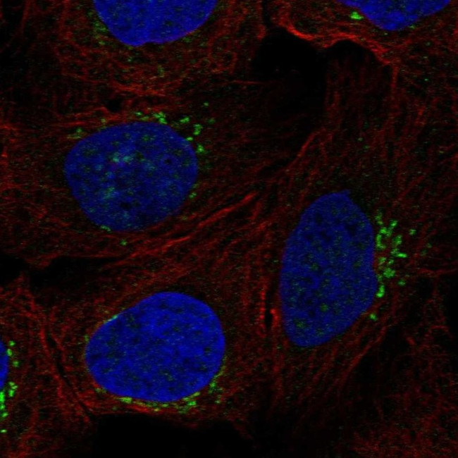 RGS18 Antibody in Immunocytochemistry (ICC/IF)