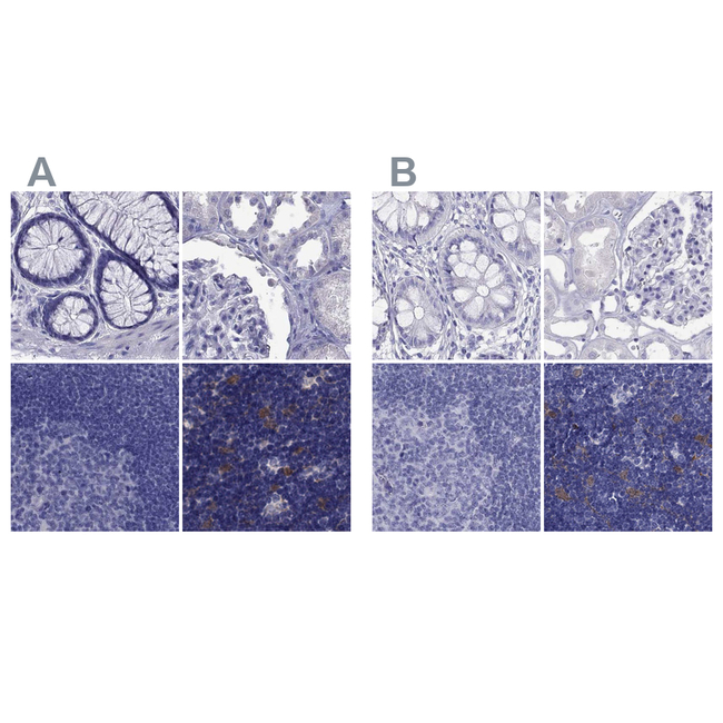 PSMB11 Antibody in Immunohistochemistry (Paraffin) (IHC (P))