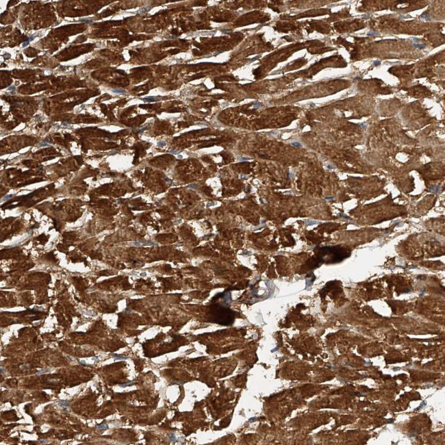 PTPRA Antibody in Immunohistochemistry (Paraffin) (IHC (P))