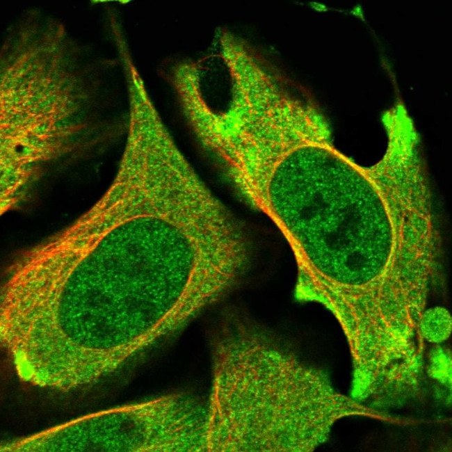 PRKD3 Antibody in Immunocytochemistry (ICC/IF)