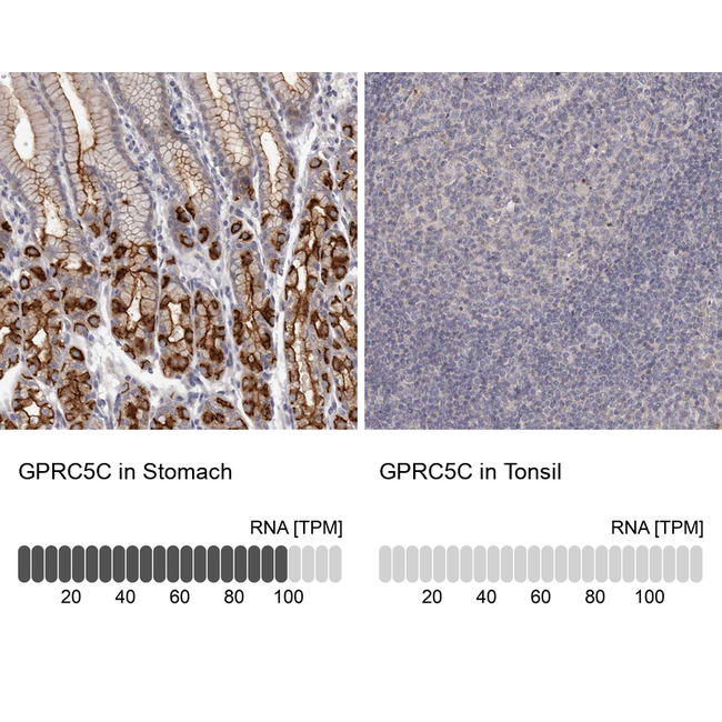 GPRC5C Antibody in Immunohistochemistry (Paraffin) (IHC (P))