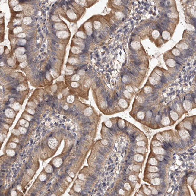 SLC22A1 Antibody in Immunohistochemistry (Paraffin) (IHC (P))