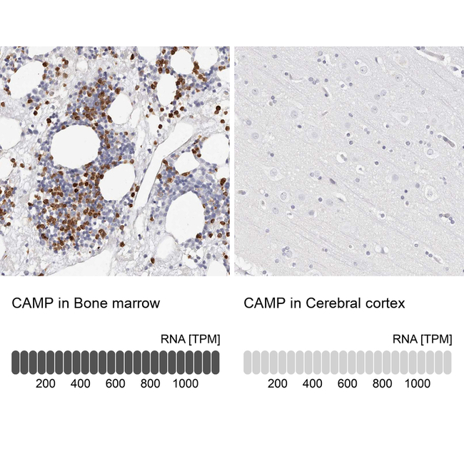 Cathelicidin Antibody in Immunohistochemistry (Paraffin) (IHC (P))