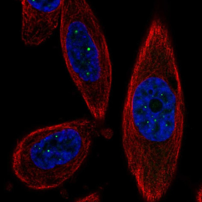 TSACC Antibody in Immunocytochemistry (ICC/IF)
