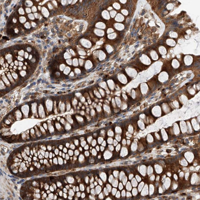 C21orf2 Antibody in Immunohistochemistry (Paraffin) (IHC (P))
