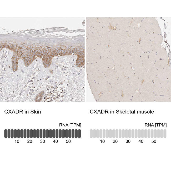 CAR Antibody in Immunohistochemistry (Paraffin) (IHC (P))