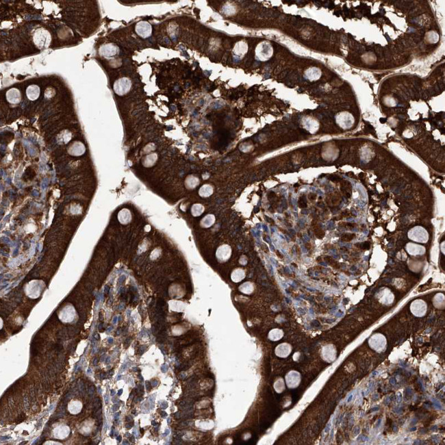 CD267 (TACI) Antibody in Immunohistochemistry (Paraffin) (IHC (P))