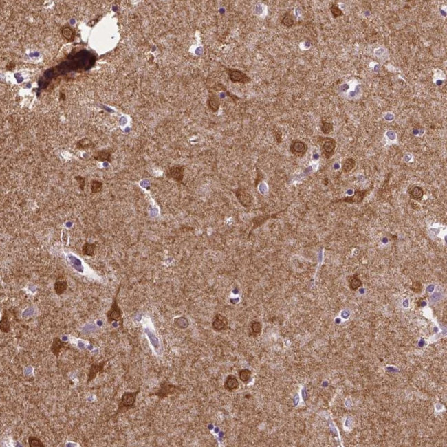 STEP Antibody in Immunohistochemistry (Paraffin) (IHC (P))