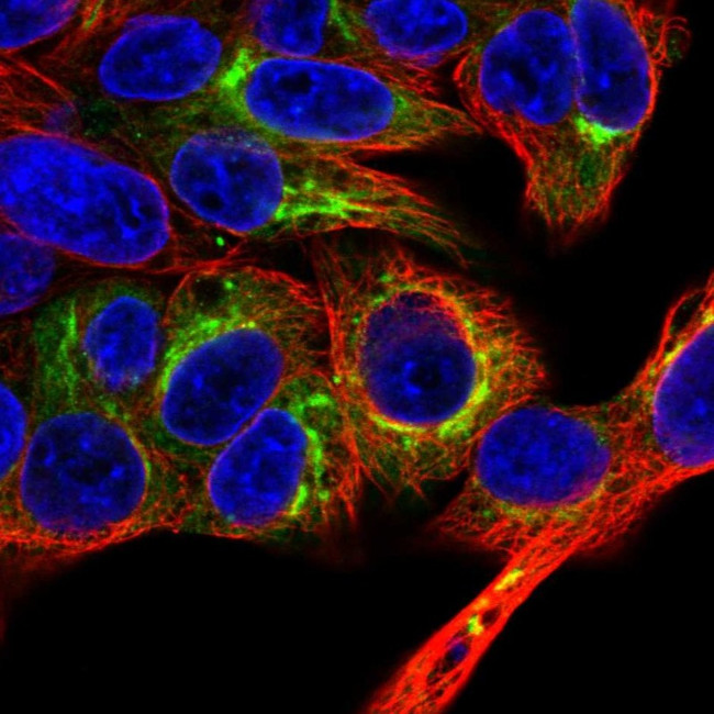 Albumin Antibody in Immunocytochemistry (ICC/IF)