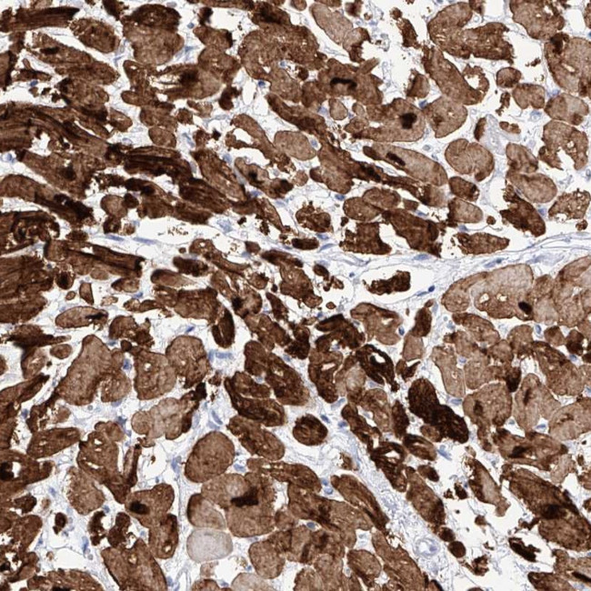 TRPC7 Antibody in Immunohistochemistry (Paraffin) (IHC (P))