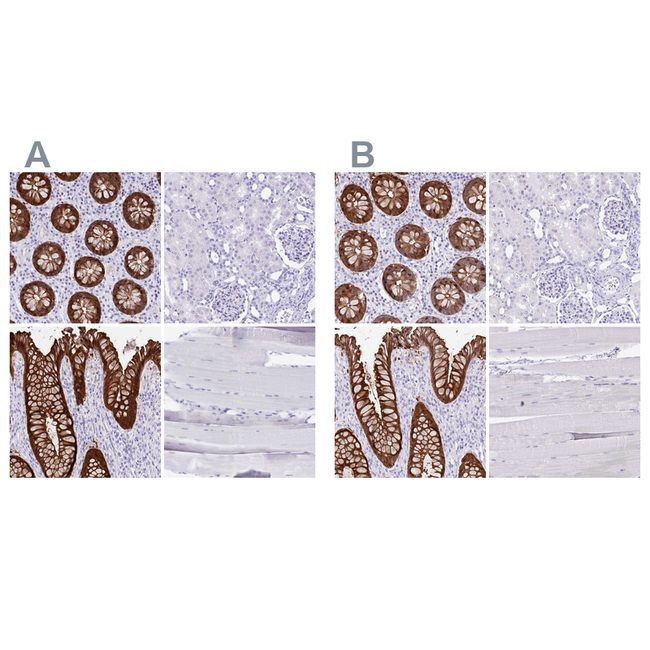 Galectin 4 Antibody in Immunohistochemistry (Paraffin) (IHC (P))