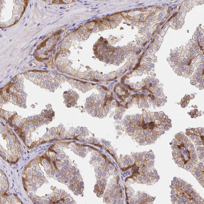 SORL1 Antibody in Immunohistochemistry (Paraffin) (IHC (P))