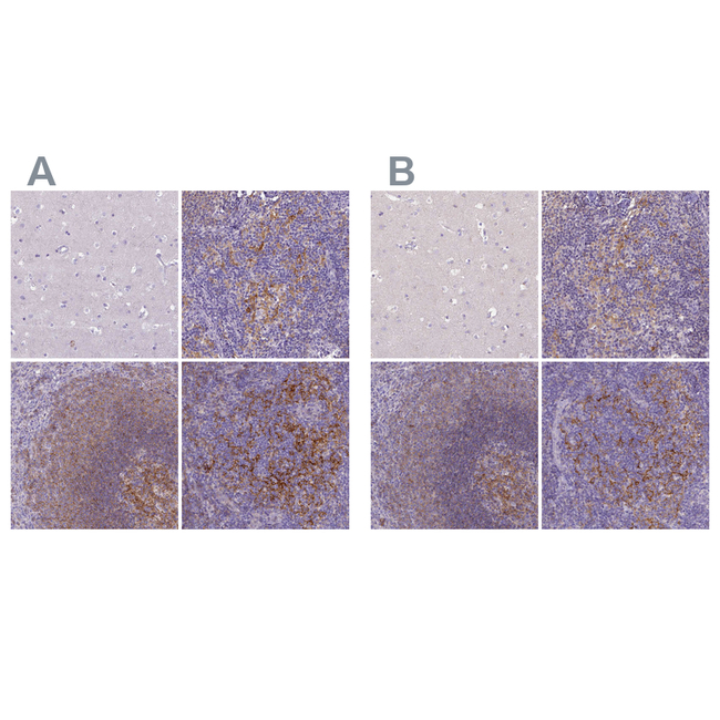 CD40 Antibody in Immunohistochemistry (Paraffin) (IHC (P))