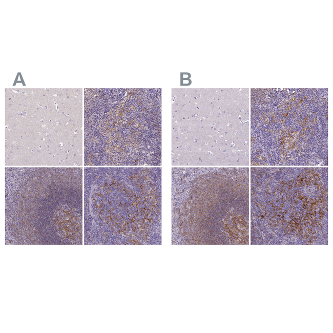 CD40 Antibody in Immunohistochemistry (Paraffin) (IHC (P))