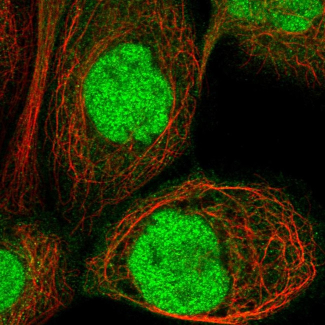 HSF2BP Antibody in Immunocytochemistry (ICC/IF)