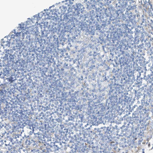 HIC2 Antibody in Immunohistochemistry (Paraffin) (IHC (P))