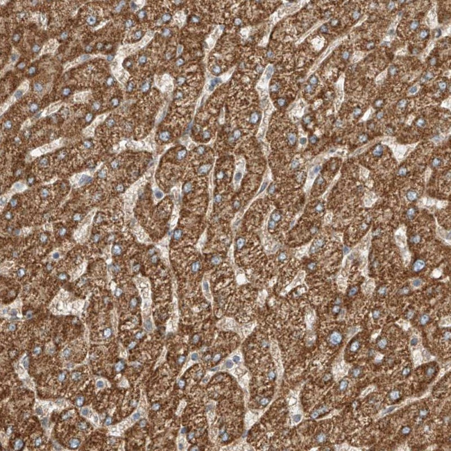 ABCC11 Antibody in Immunohistochemistry (Paraffin) (IHC (P))