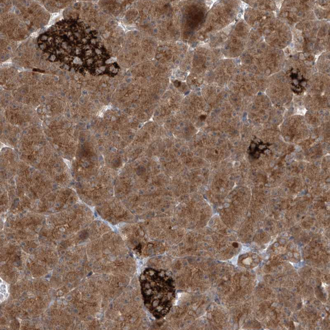 PDE11A Antibody in Immunohistochemistry (Paraffin) (IHC (P))