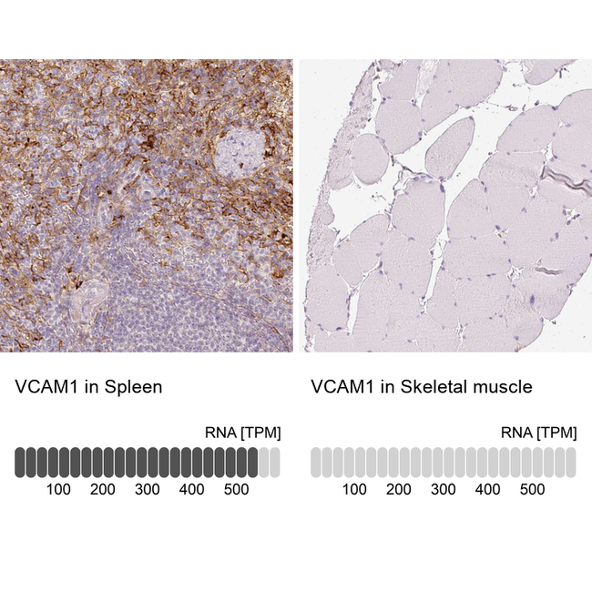 VCAM-1 Antibody in Immunohistochemistry (Paraffin) (IHC (P))