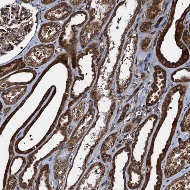 ATP2C1 Antibody in Immunohistochemistry (Paraffin) (IHC (P))