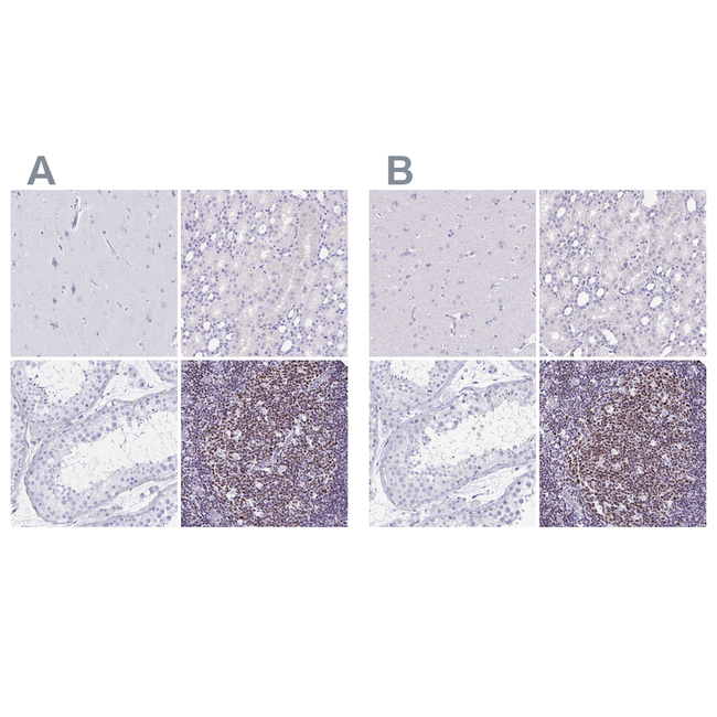 IKAROS Antibody in Immunohistochemistry (Paraffin) (IHC (P))