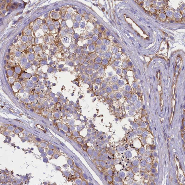 CD99 Antibody in Immunohistochemistry (Paraffin) (IHC (P))