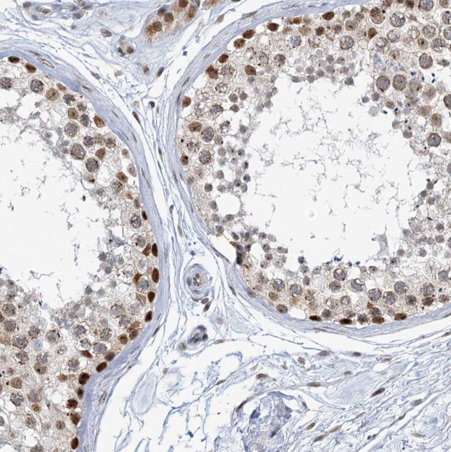 TREX1 Antibody in Immunohistochemistry (Paraffin) (IHC (P))