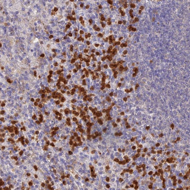 NCF4 Antibody in Immunohistochemistry (Paraffin) (IHC (P))
