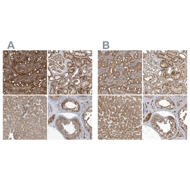 TRIP Antibody in Immunohistochemistry (Paraffin) (IHC (P))