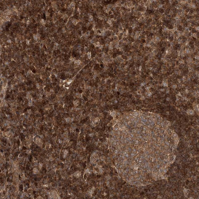 ALS2CR1 Antibody in Immunohistochemistry (Paraffin) (IHC (P))