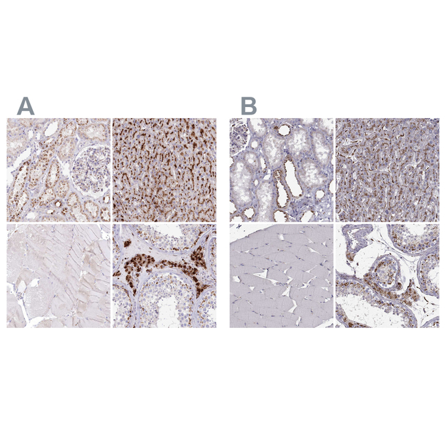 CLN2 Antibody in Immunohistochemistry (Paraffin) (IHC (P))