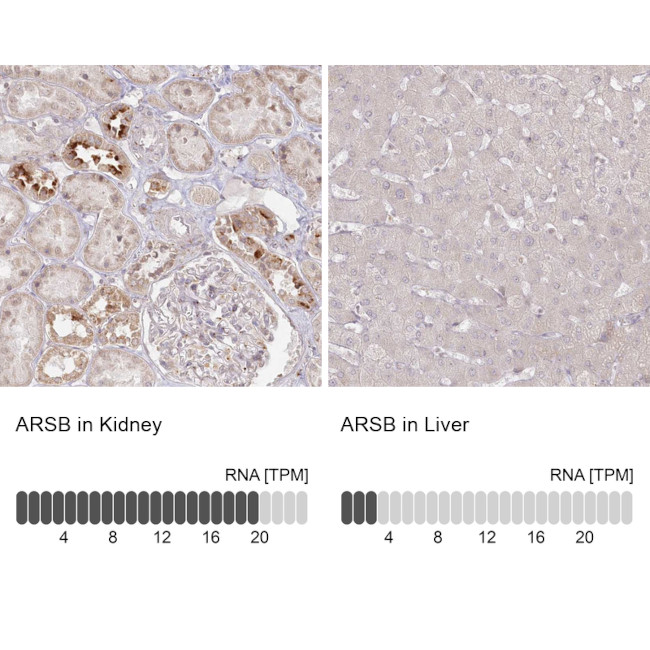 Arylsulfatase B Antibody in Immunohistochemistry (Paraffin) (IHC (P))