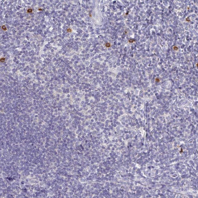TNIP1 Antibody in Immunohistochemistry (Paraffin) (IHC (P))