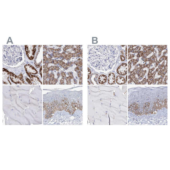 MCCC2 Antibody in Immunohistochemistry (Paraffin) (IHC (P))