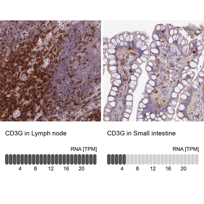 CD3g Antibody in Immunohistochemistry (Paraffin) (IHC (P))