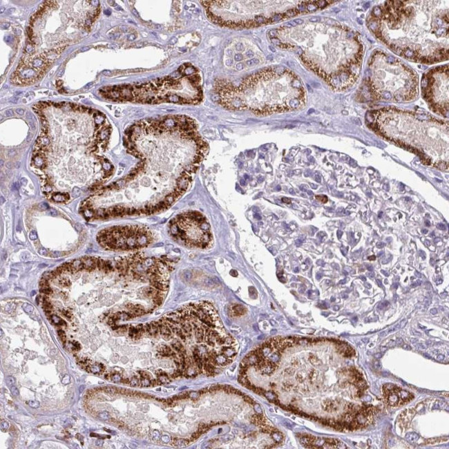 HEF1 Antibody in Immunohistochemistry (Paraffin) (IHC (P))