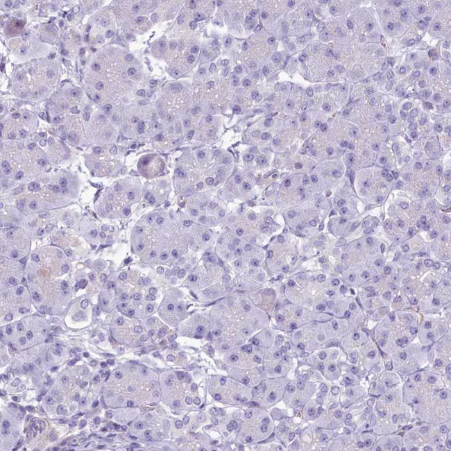 EPCR Antibody in Immunohistochemistry (Paraffin) (IHC (P))