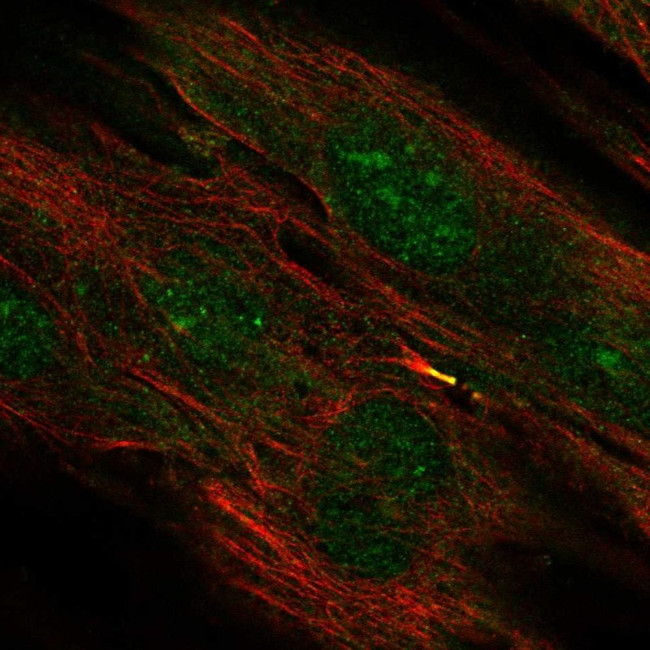 TMEM117 Antibody in Immunocytochemistry (ICC/IF)